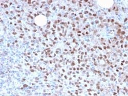 MITF Antibody (MITF/2987R) - Azide and BSA Free, Novus Biologicals 100 &mu;g | Buy Online | Novus Biologicals | Fisher Scientific